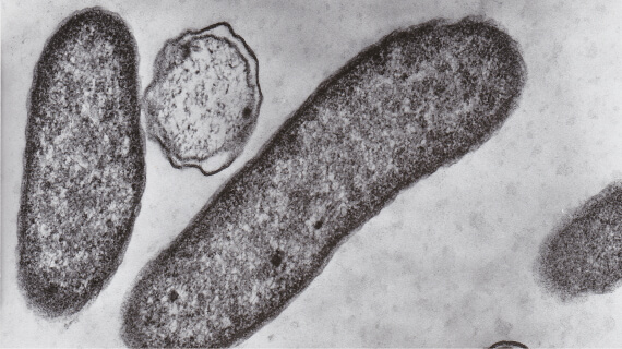 桿菌のTEM画像